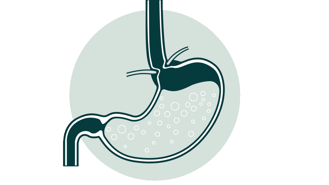 How Khelp works to prevent acid reflux animated gif